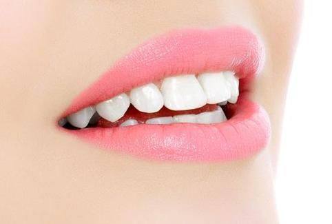 重度黄牙的贴面修复价格