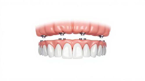 影响放牙冠时间的其他因素