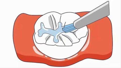 口腔医院看牙的优势