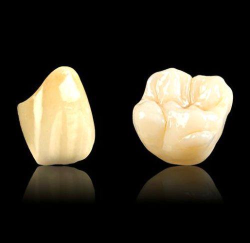 全瓷牙的咀嚼承受力与耐磨表现