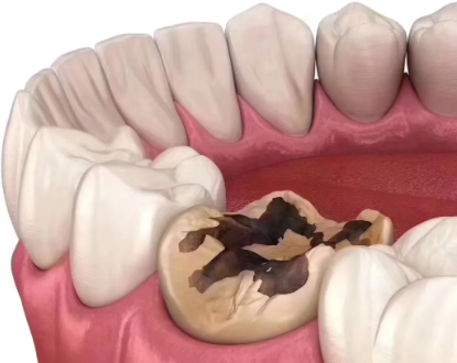 如何判断是否伤到神经?