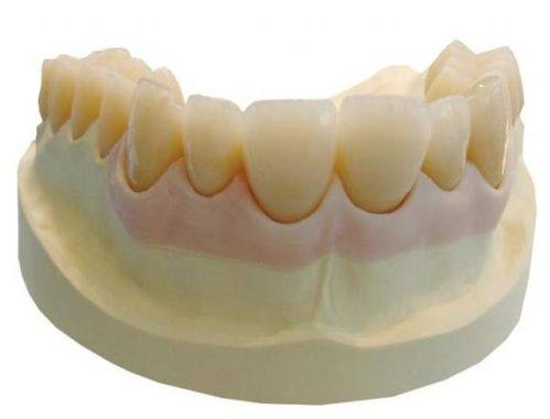 判断是否更换烤瓷牙的关键依据