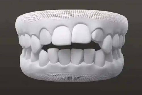 手术矫正法：重度畸形的解决方案