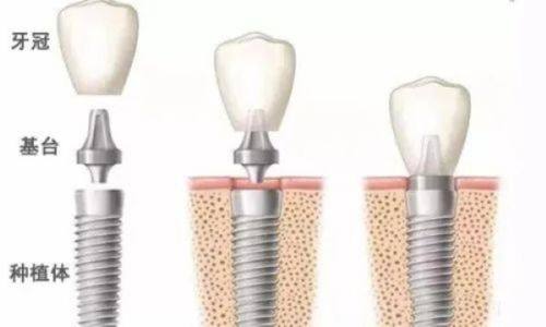 医院收费标准的影响