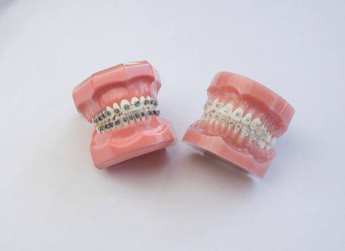 拔牙问题：心疼与担忧是否必要？