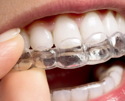 重新粘接，有啥前提条件？