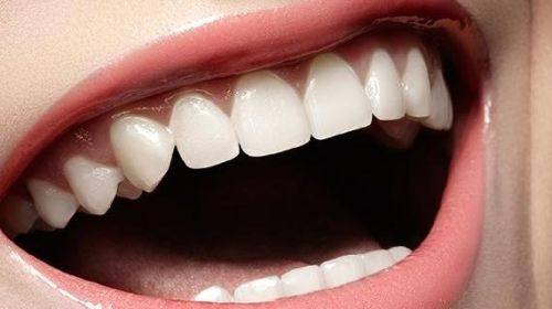 烤瓷牙崩了一块可以修复吗？告诉你修复的3个关键点！