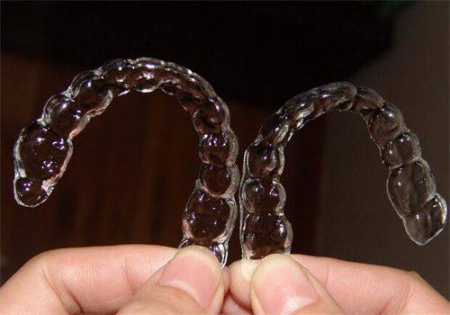 舌侧矫正：极致美观的秘密武器