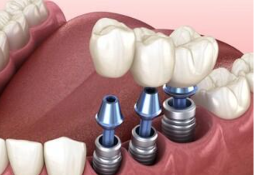 如何预防后遗症