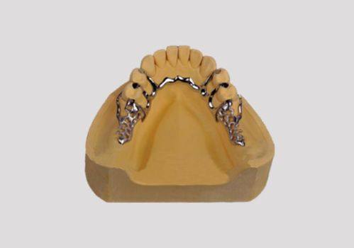 活动义齿能正常吃东西吗？揭秘使用技巧与注意事项！