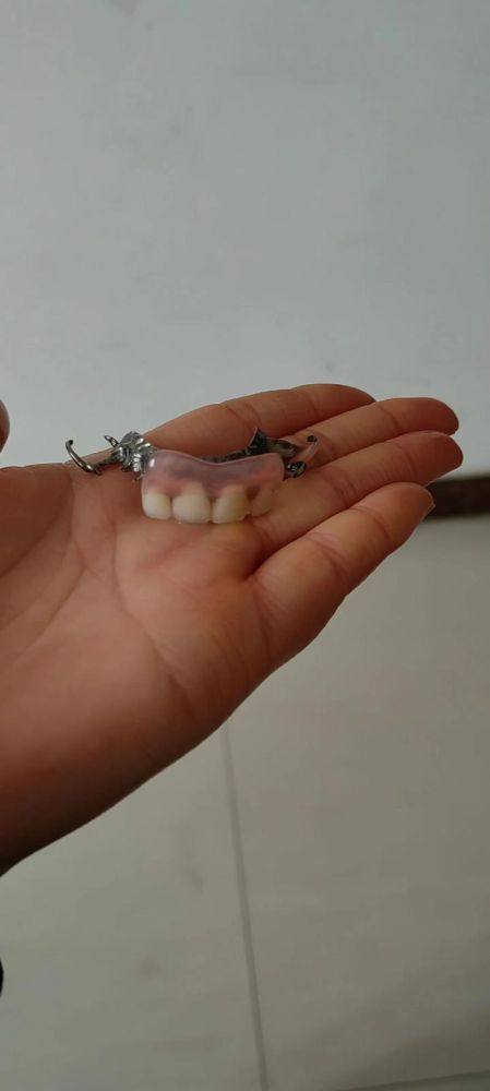 全瓷牙能用一辈子吗？揭秘持久性的真相与护理技巧！