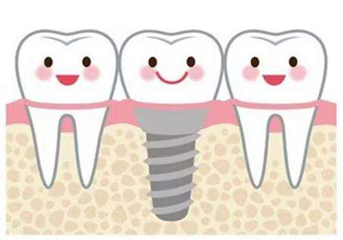了解烤瓷牙冠的5大优势，助你重拾自信微笑！