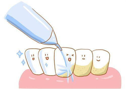 洗牙的适用人群及建议