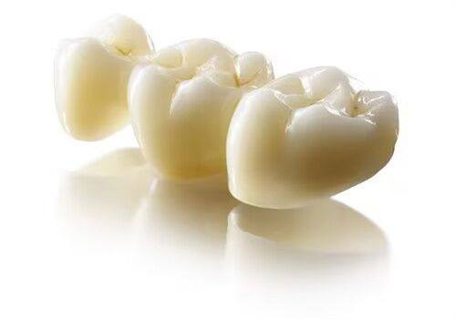 不同人群牙齿美白维持时间的差异