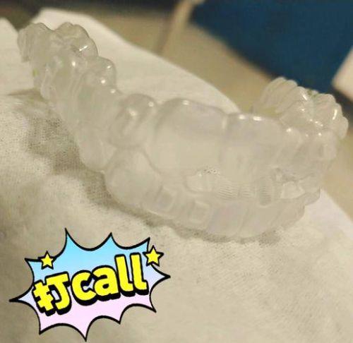 一天换一次牙套的情况及适用人群