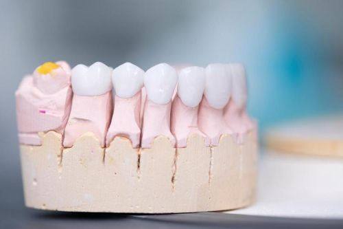 烤瓷牙做核磁共振有危险吗？了解真相，保护口腔健康！