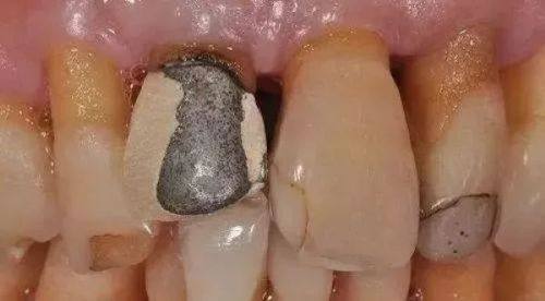 检查前的注意事项