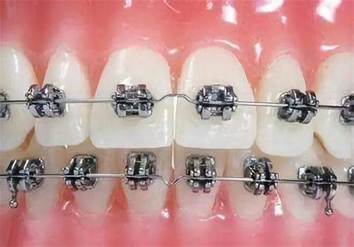 所在城市差异明显