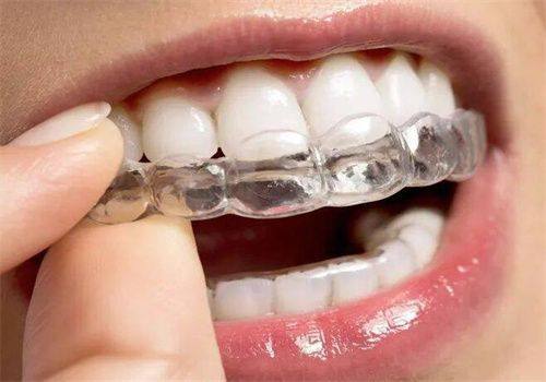 揭秘牙齿矫正后反弹的3大关键因素