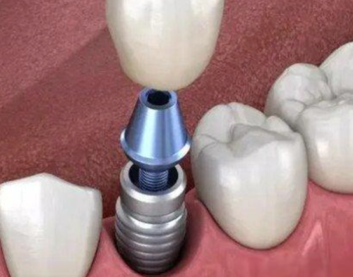 检查前的注意事项