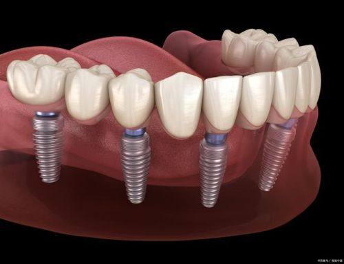 影响疼痛症状消失时间的因素