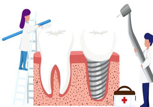如何选择合适的种植牙医院和医生