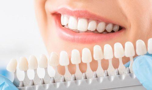 牙齿美白的成效与注意事项