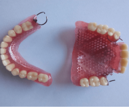 口腔健康状况对佩戴活动假牙的影响