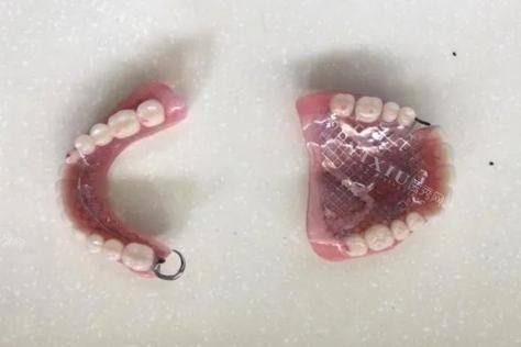 活动假牙适合年轻人吗？揭秘年轻人选择的5大理由！