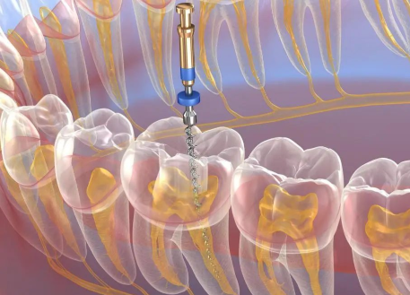 维护不佳，疼痛易现