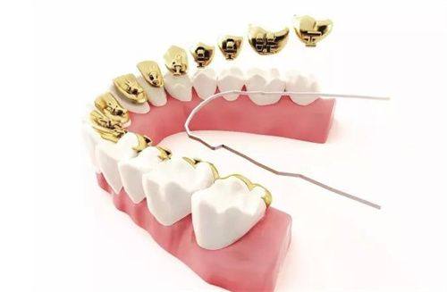 小颌畸形的至佳矫正年龄