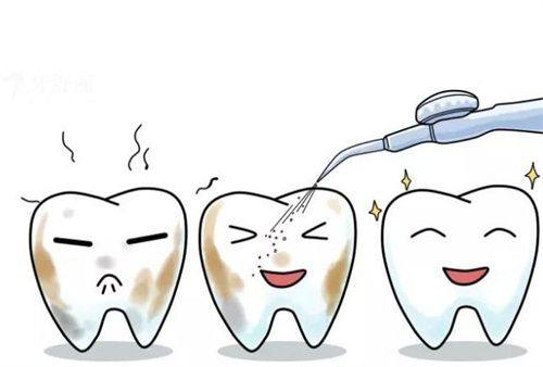 洗牙一般多久能洗完？揭秘专业牙医的真实时间！