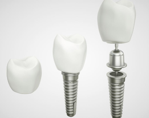 不同种植方式及费用