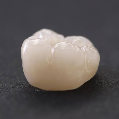 烤瓷牙套寿命一般几年？揭秘持久美牙的秘密！