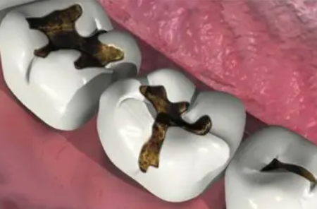 影响心理健康：自信与社交的缺失