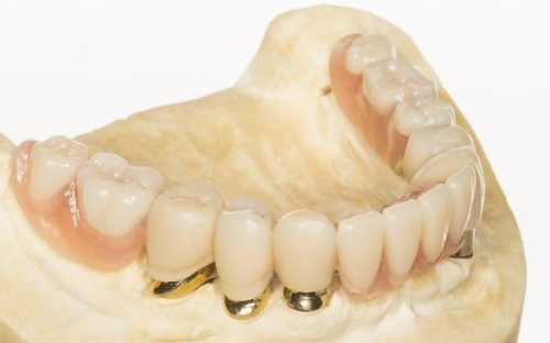 应对策略与建议