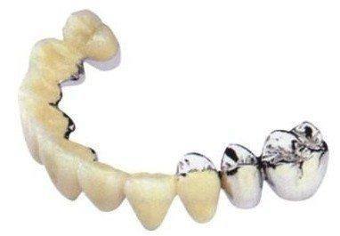 有烤瓷牙需要做核磁共振怎么办？一文详细解答！