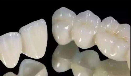 烤瓷牙对做核磁共振有影响吗？解答你关心的问题！