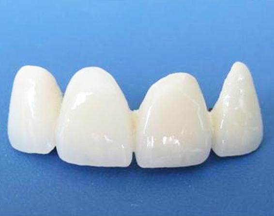 普通烤瓷牙能做核磁吗？揭秘真相与注意事项！