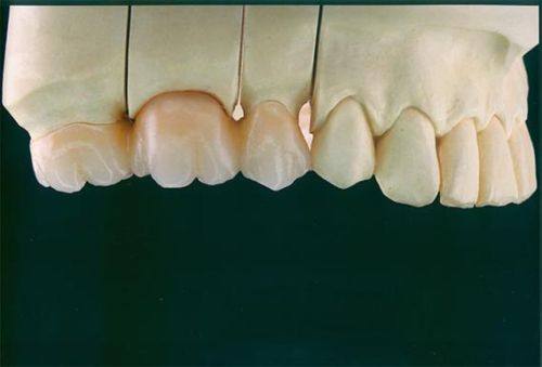 经济压力：价格偏高带来负担