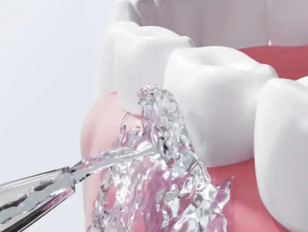 洗牙后忌口的时间范围