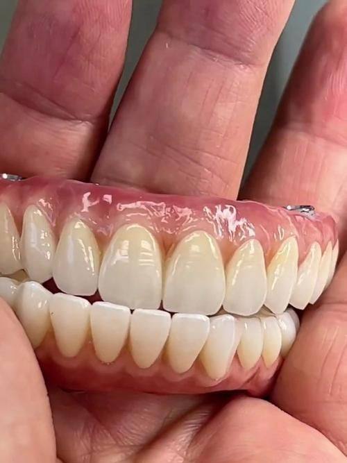 烤瓷牙一阵一阵痛怎么办？这5个方法让你轻松缓解！