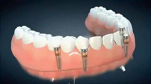 品牌定位：各有千秋