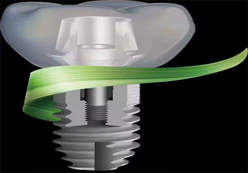 2026瑞士种植牙价格体系