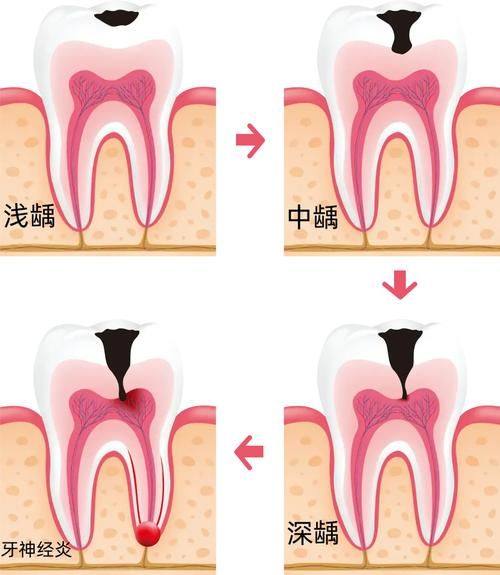 预防建议——守护宝宝口腔健康