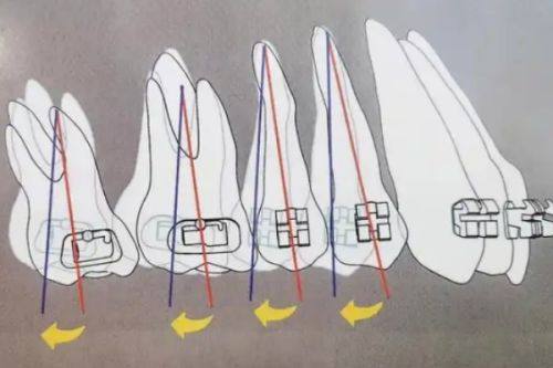 不建议短时间内饮酒的原因