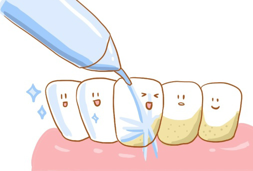 洗牙后喝水的相关要点