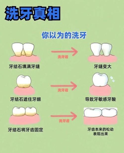 不同人群洗牙后的注意差异