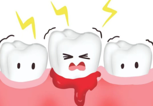 牙龈出血要警惕三种病！你知道吗？