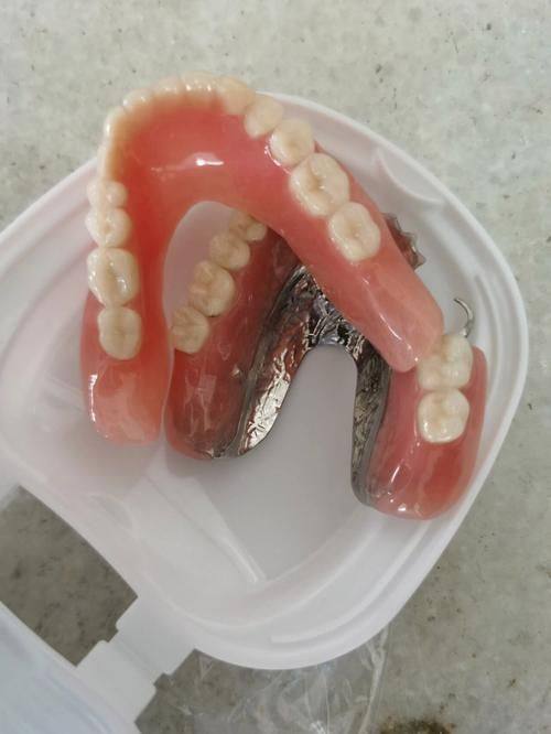 活动义齿的优缺点